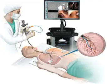 Bronchoscopy